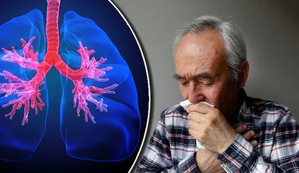 Bronsita, emfizem si astm bronsic: Cum te afecteaza BPOC?