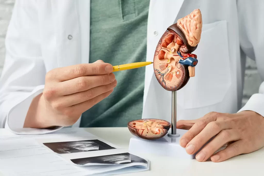 Chisturile la rinichi: cauze, simptome, diagnostic si tratament